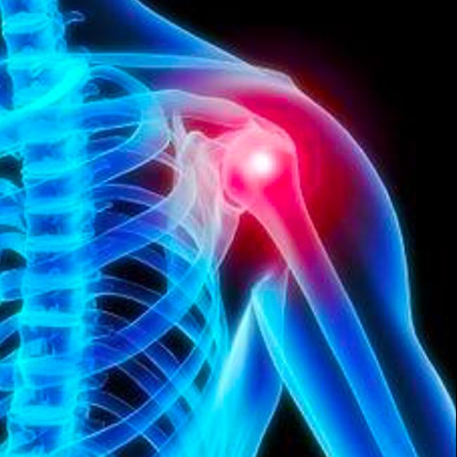 Antrim Rheumatology Undergraduate Education