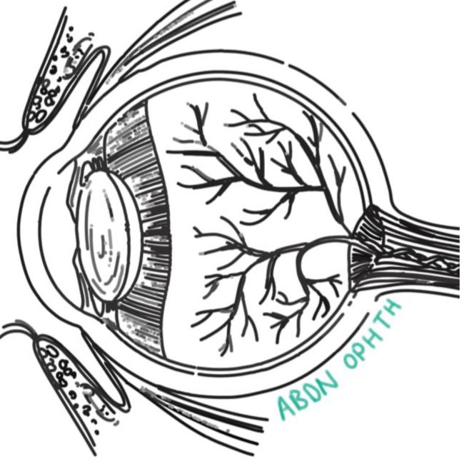 Aberdeen University Ophthalmology Society