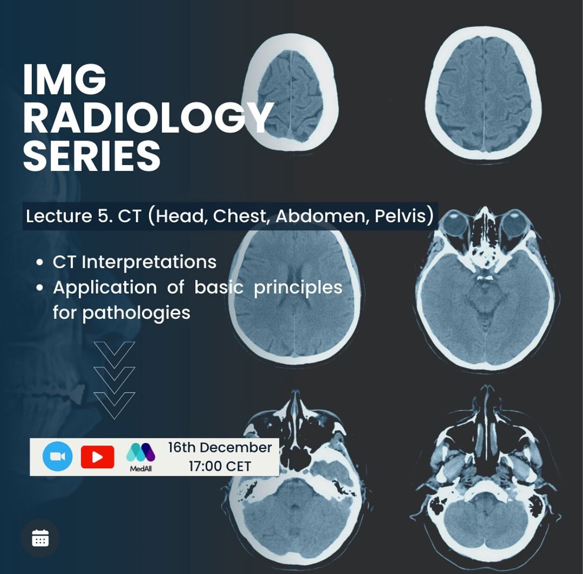IMG Radiology Series: CT (Head, Thorax, Abdomen, Pelvis) | Event ...